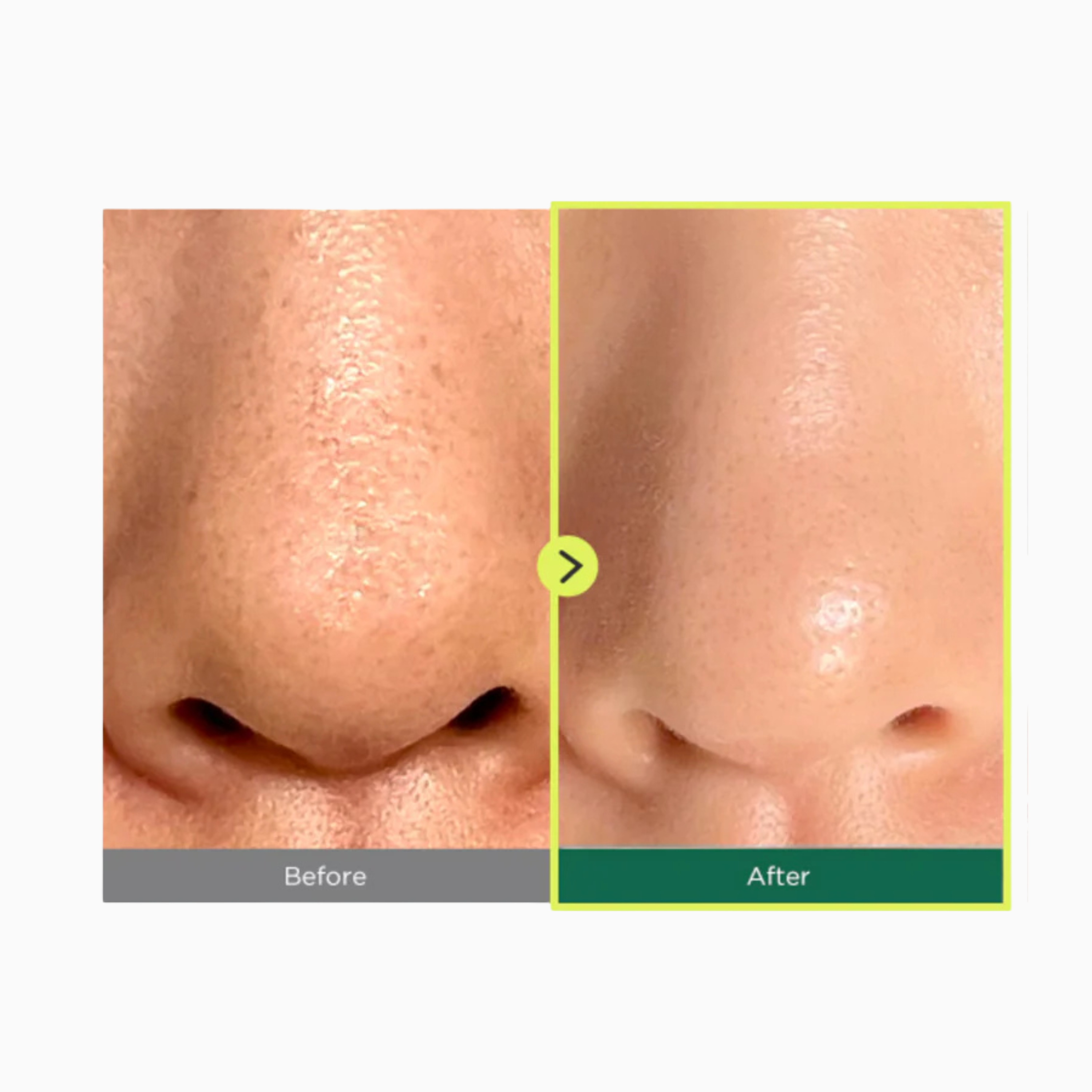 ANUA - Heartleaf Pore Control Cleansing Oil | olio detergente