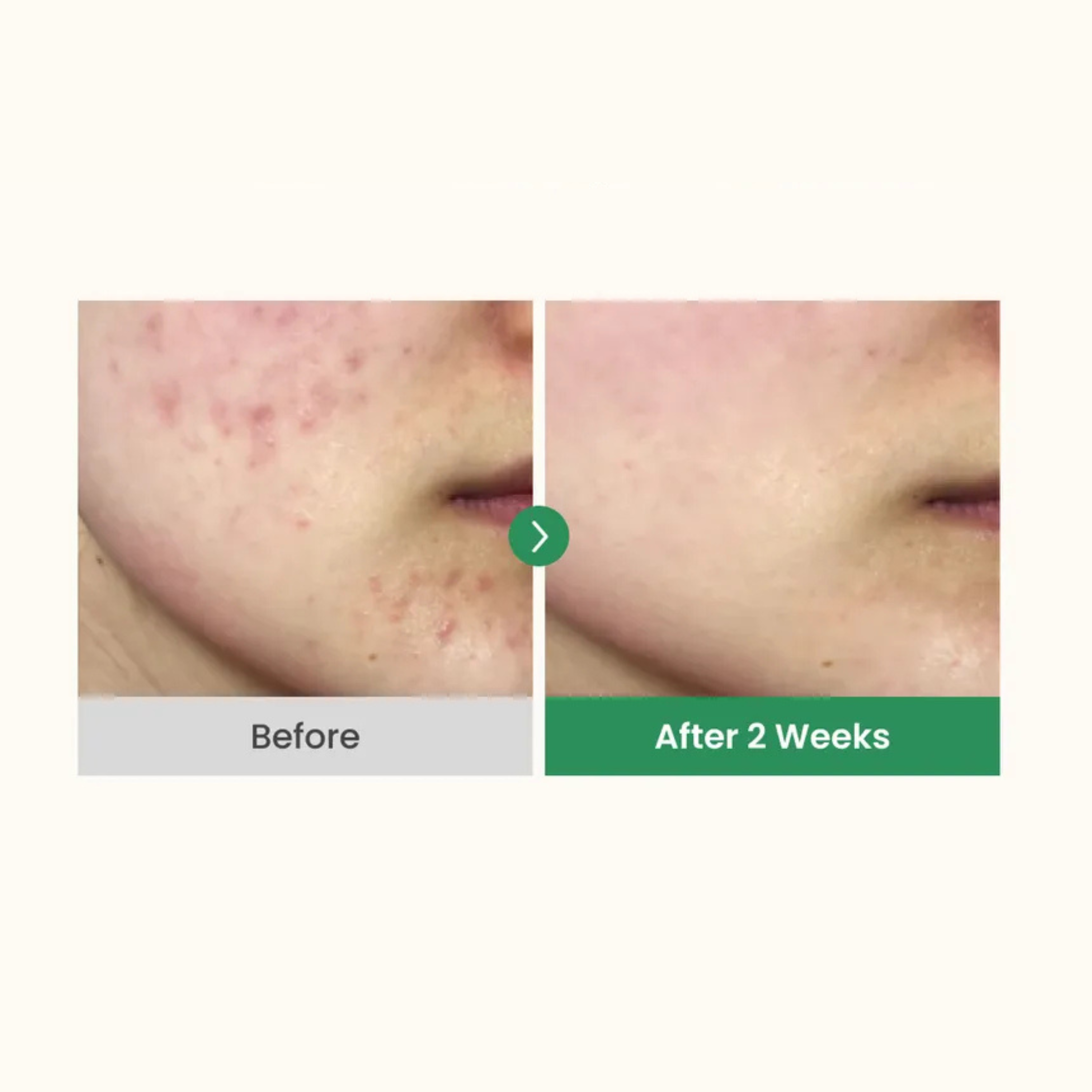 AXIS-Y Dark Spot Correcting Glow Serum