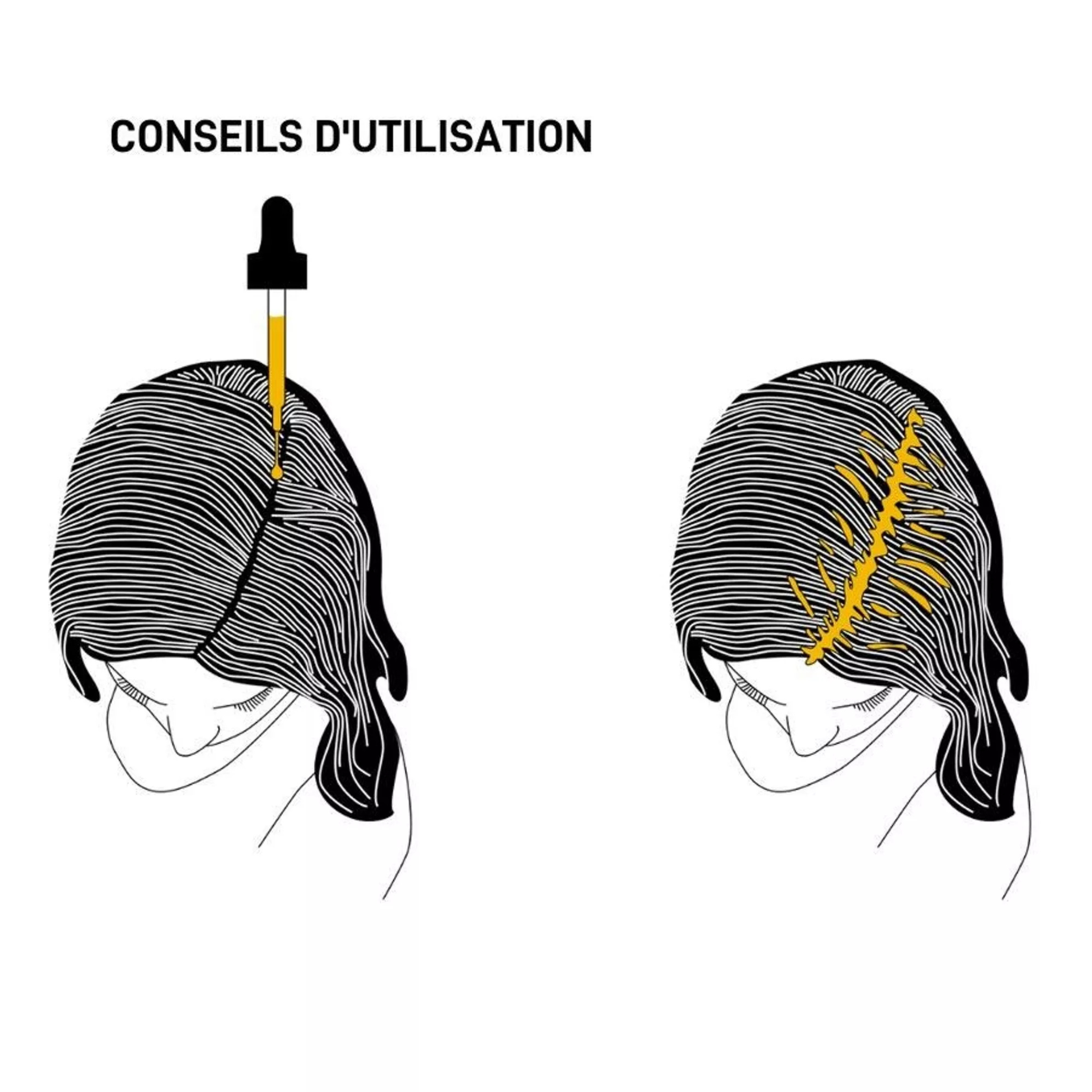 SERGE D'ESTEL - Suero anticaída